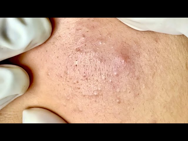 Satisfying video with Chung Vo Spa | 257