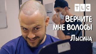 Лысина | Верните Мне Волосы | Tlc