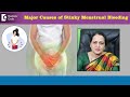 Major Causes of Stinky Menstrual Bleeding - Is it due to infection?-Dr.H S Chandrika|Doctors