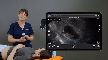 Crown Rump Length CRL Measurement