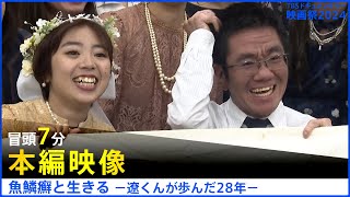 【本編冒頭7分】魚鱗癬と生きる−遼くんが歩んだ28年−│TBSドキュメンタリー映画祭2024