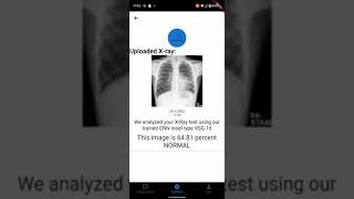 Pneumonia detection App Created Using Flutter screenshot 4