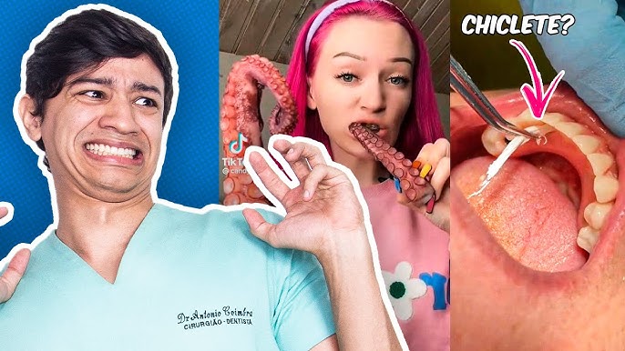 Dentes de vampiro: moda entre adolescentes no TikTok causa danos à