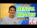 DENTAL BRACES: FAQs ( Question and Answer )