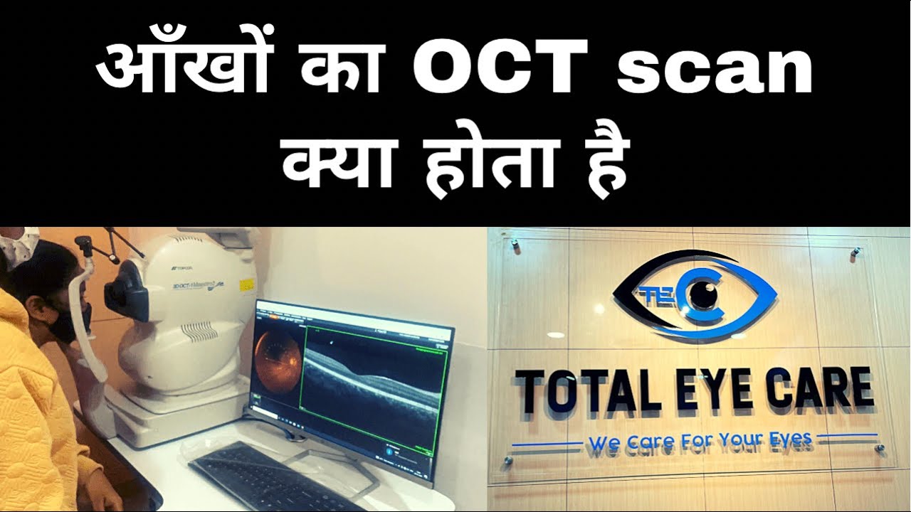 Eye Ka OCT Scan Kya Hota Hai Total Eye Care Kolkata YouTube Eye Ka OCT Scan Kya Hota Hai Total Eye Care Kolkata YouTube