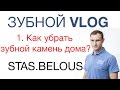 1.Зубной Vlog.  Удалить зубной камень в домашних условиях Stas Belous