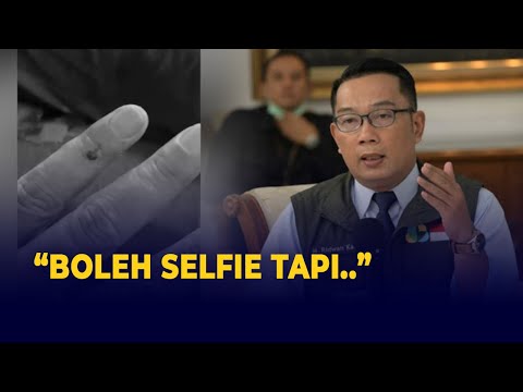 Download Ridwan Kamil Alami Luka Cakar Saat Kerja: Boleh Selfie, Tapi Please Jangan KDRT