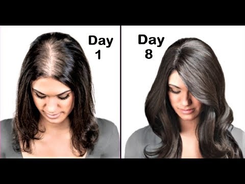 She Had Very Thin Hair She Used This Got Thick Hair In 1 Week