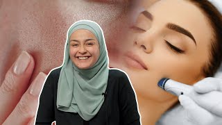 Sebaceous Filaments: Telaga pada Muka