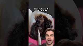 How To Save This Tooth Step By Step