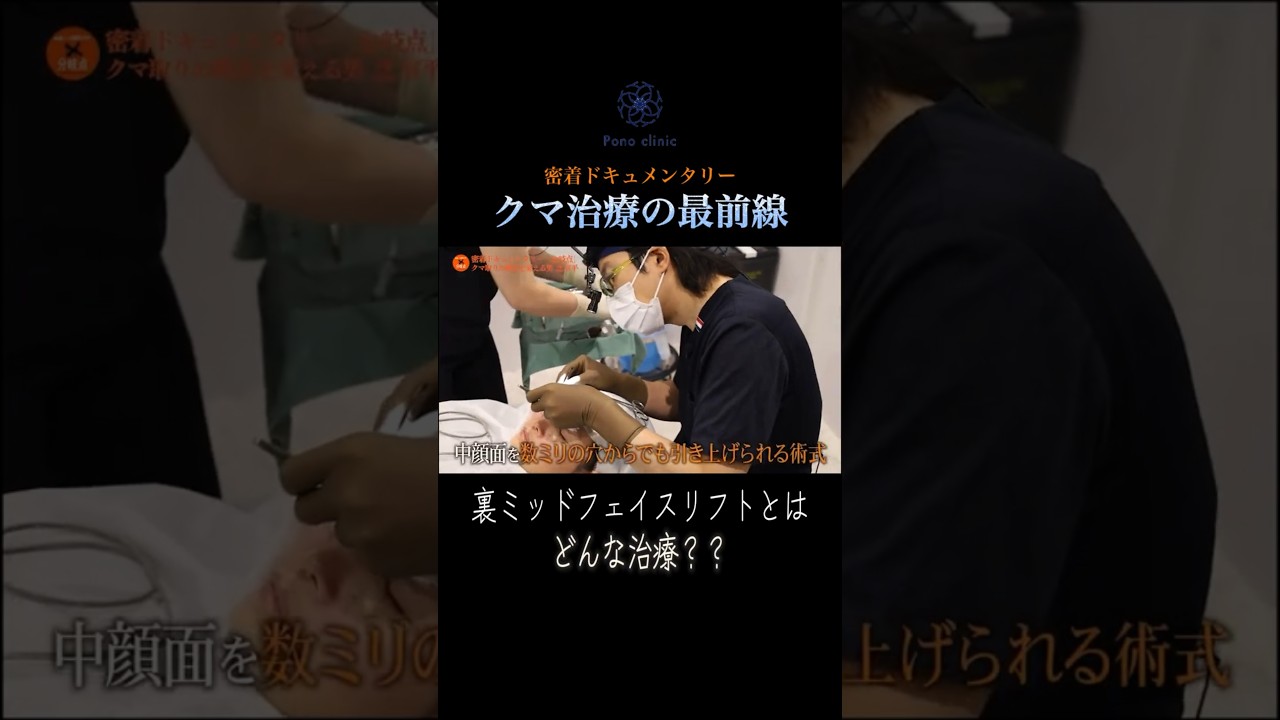クマ治療の概念を変える「裏ミッドフェイスリフト」とはどんな治療なのか? #ドキュメンタリー #医者 #手術 #クマ取り #密着