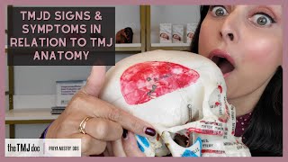 TMJD Signs & Symptoms in Relation to TMJ Anatomy - Priya Mistry, DDS (the TMJ doc) #tmd #tmj