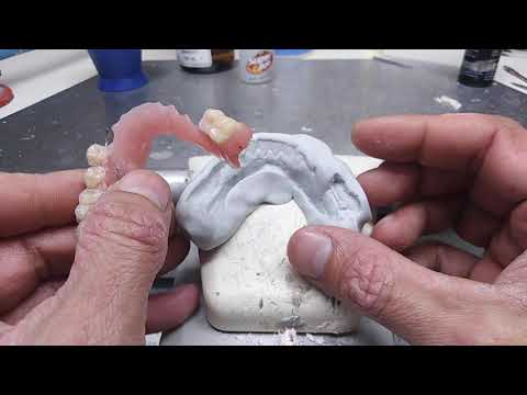 Riparazione protesi mobile. 6 Dental Formula project