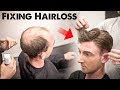 Mens Hairloss Treatment 2.0 | Amazing Hairstyle Transformation - Does it Work? | BluMaan 2018