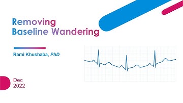 Removing Baseline Wandering