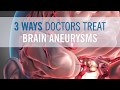 3 Ways Doctors Can Treat Your Brain Aneurysm