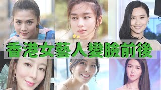 23位香港女星整容前後 原來她她她也有變臉成功vs失敗案例