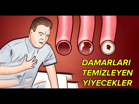 Video: Evdəki ürək-damar Avadanlığı Ilə Rəqəminizə Və Sağlamlığınıza Diqqət Yetirin