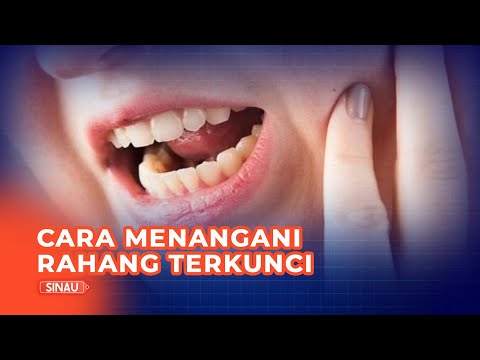 Video: Cara Memperbaiki Rahang Terkilir: 12 Langkah (dengan Gambar)