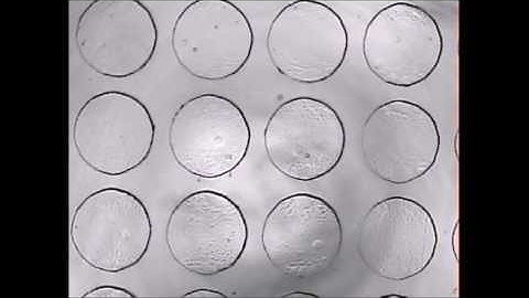 Trapping of Au Nanoparticles in a Microfluidic Device using Dielectrophoresis