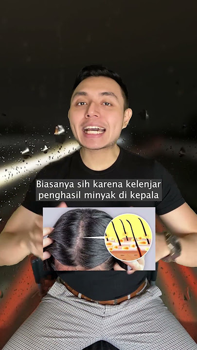 Where does dandruff come from?