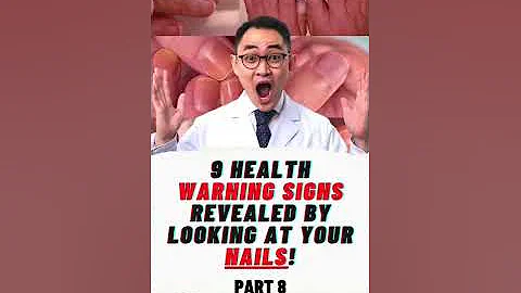 9 HEALTH WARNING SIGNS REVEALED BY LOOKING AT YOUR NAILS! Part 8 #shorts