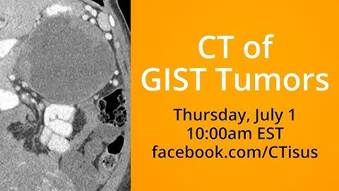 Facebook Live: CT of GIST Tumors
