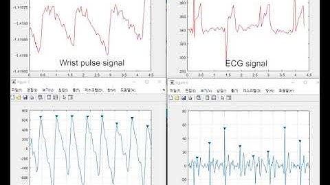 Porous Elastomer and Carbon Nanotube towards High Performance Capacitive Pressure Sensors
