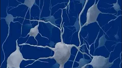 Mayo Clinic Medical Animation - Lewy Body Dementia
