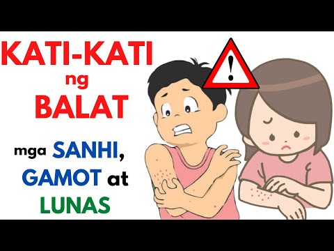 Video: 7 Payak at Mabisang Paraan upang mapawi ang Makati na mga binti