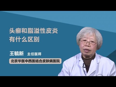 头癣和脂溢性皮炎有什么区别 王毓新 北京华医中西医结合皮肤病医院