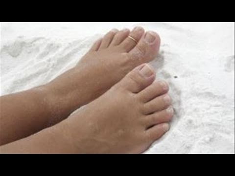 How To Manage Friction Blisters