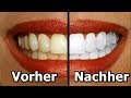 5 natürliche Hausmittel, die deine Zähne aufhellen!