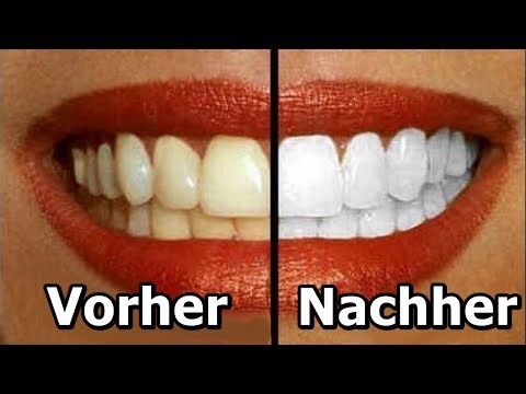 Video: Wie Man Gelbe Zähne Loswird: 7 Hausmittel