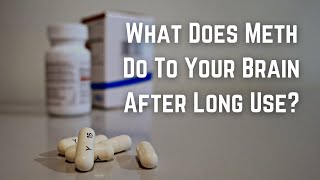 What Does Meth Do To Your Brain After Long Use?