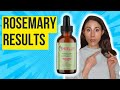 Rosemary Oil for Hair Growth: Benefits, Risks, and Product Recommendations