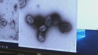 Cuyahoga County Board of Health reports mpox outbreak