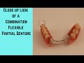 Flexible Partial Denture, a close look at a combination flexible partial denture.