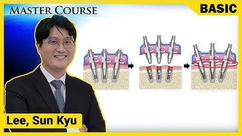 [Master Course Season2 - BASIC] Implant level impression taking