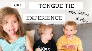 Our Tongue Tie Experience | TONGUE TIE RELEASE BEFORE AND AFTER | Bumblebee Apothecary