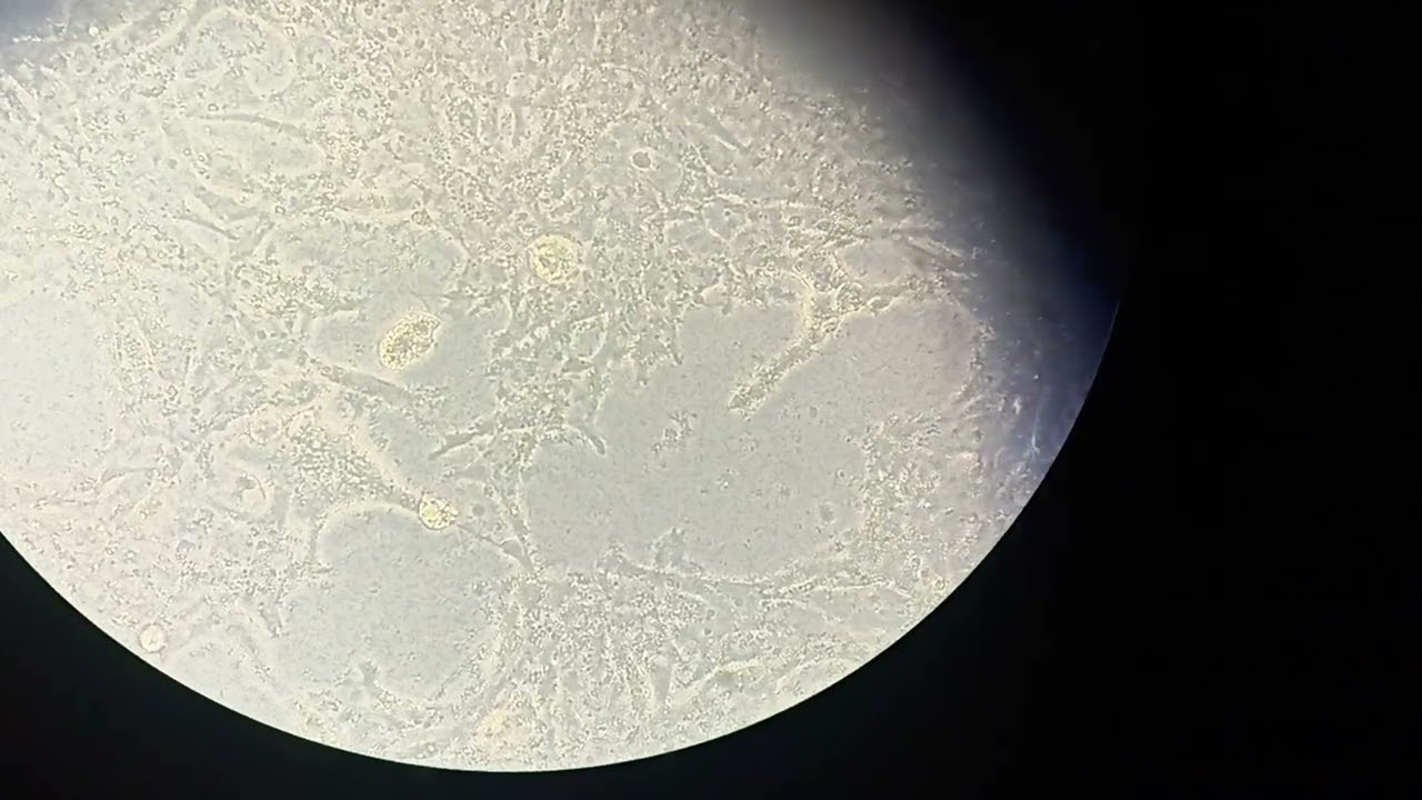 Bacterial contamination in HEK293T cells