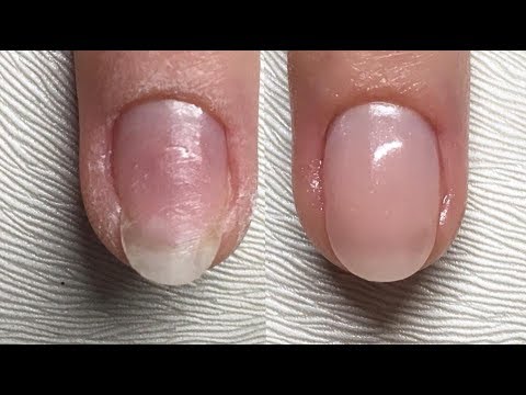 Eingerissene Nagel Ohne Schablone Mit Acrylgel Reparieren Youtube