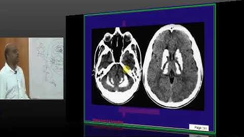 NEETPG Image based MCQ Mock Test Discussion 1624 Lec 03 Download uMedico App