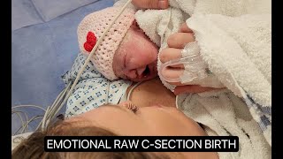 RAW CAESAREAN SECTION - EMOTIONAL DELIVERY OF BABY NUMBER 6.