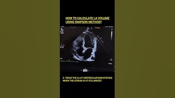 How to calculate LA Volume? #echocardiography #echo #cardiology #ultrasound #sonography
