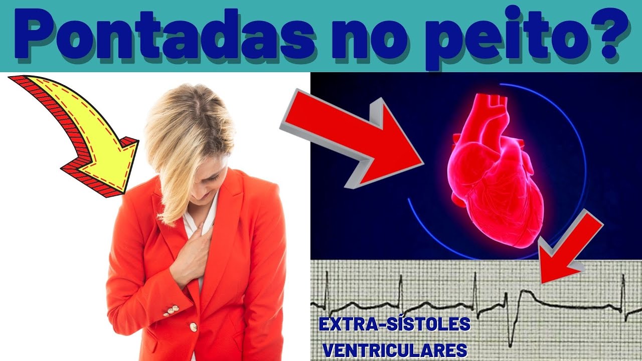 PONTADAS NO PEITO? FALHAS NO CORAÇÃO? Seu problema pode ser EXTRA-SÍSTOLES VENTRICULARES!