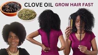 RIGHT WAY TO MAKE CLOVE OIL FOR FAST HAIR GROWTH | USE THIS TWICE A WEEK | STOP HAIR FALL