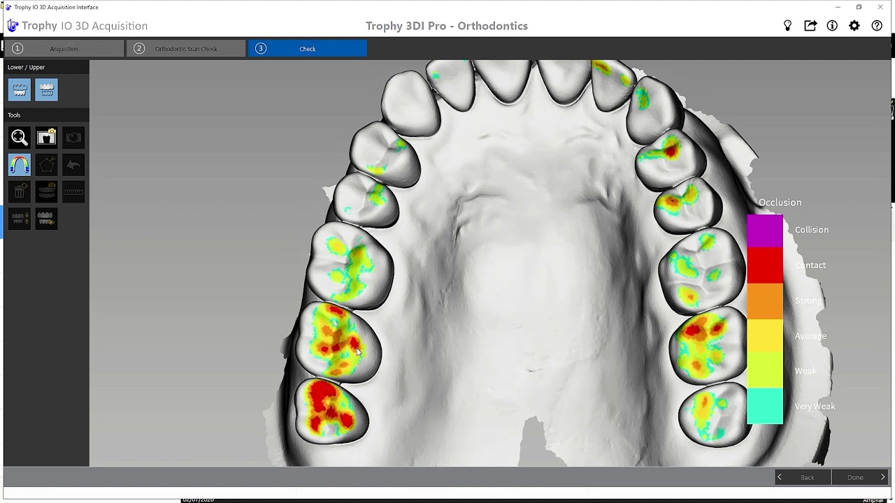 1st Rvg Trophy Imaging , TROPHY RVG FIRST® Sensor Intraoral – JLZPDQ