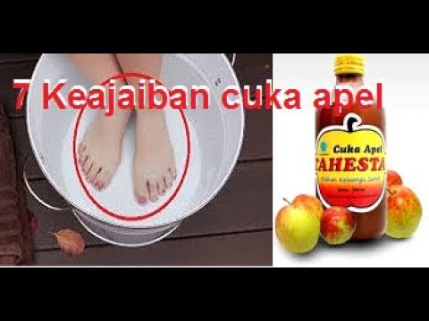 7 manfaat merendam kaki dengan cuka apel yang patut kita coba