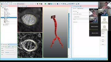 SimVascular Tutorial 4: Machine Learning 2D Segmentation